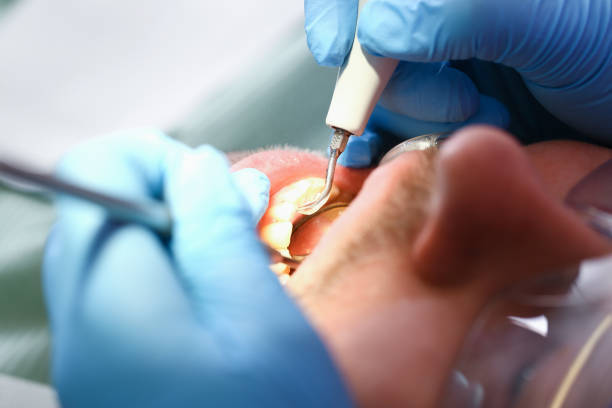 Best Emergency Dental Care for Broken or Chipped Teeth in Wake Village, TX