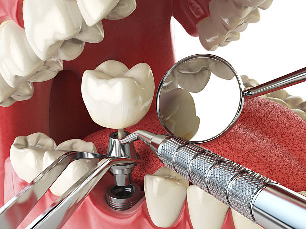 Best Emergency Dental Care for Broken or Chipped Teeth in Wake Village, TX